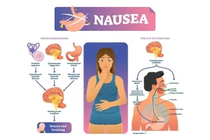 Nausea: Causes and Treatments