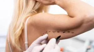 Understanding scar removal clinics and their options