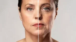 Effective strategies for removing face wrinkles